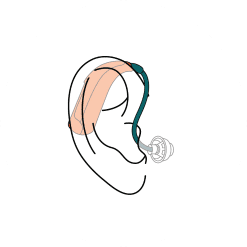 open bte hearing aids
