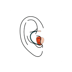 remote hearing aids